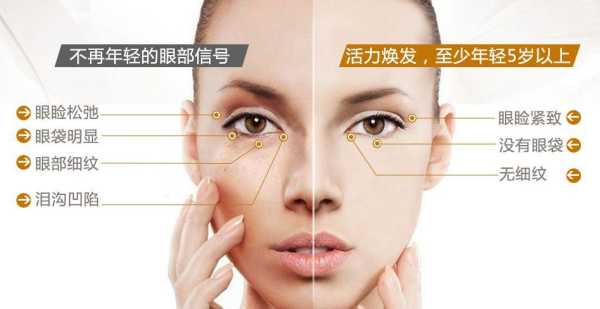 眼袋大怎么去（眼袋很严重，如何消除眼袋）