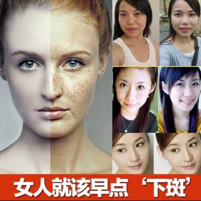 什么去斑最快（脸上长斑用什么办法淡斑最快）