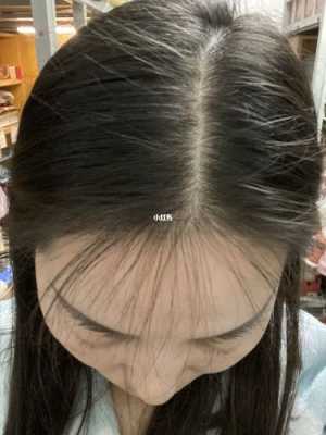 新长出来的头发是什么样的（新长出来的头发是什么样的图片）