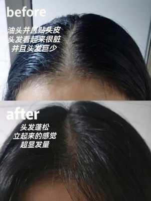 头发太粗太硬怎么变软（发质粗硬怎么变软）