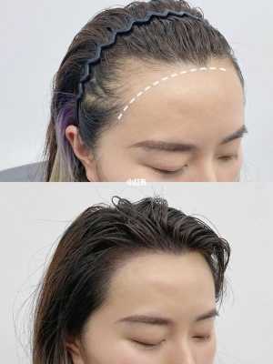 发际线不好看怎么修饰（发际线的做法）