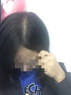 为什么有的人发量多有的人发量少,发量少为什么不能留长发