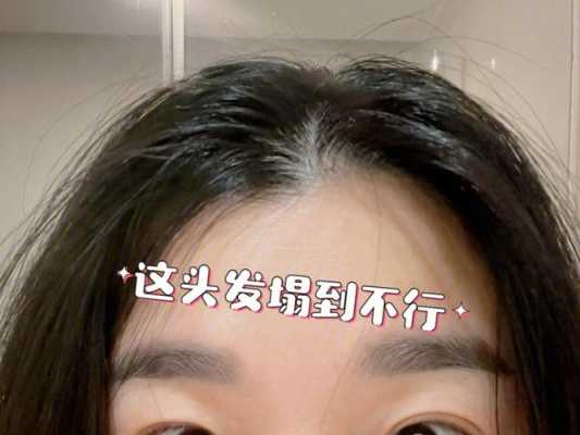 头发油了用湿毛巾擦有用吗,头皮干头发油怎么办啊