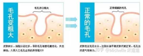 毛细孔粗大是什么原因（毛细孔粗大是什么原因造成的）