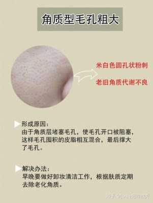 毛细孔粗大是什么原因（毛细孔粗大是什么原因造成的）