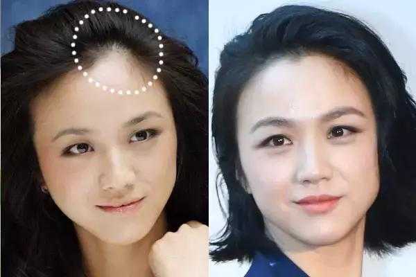 发髻线是什么（发际线在什么位置）