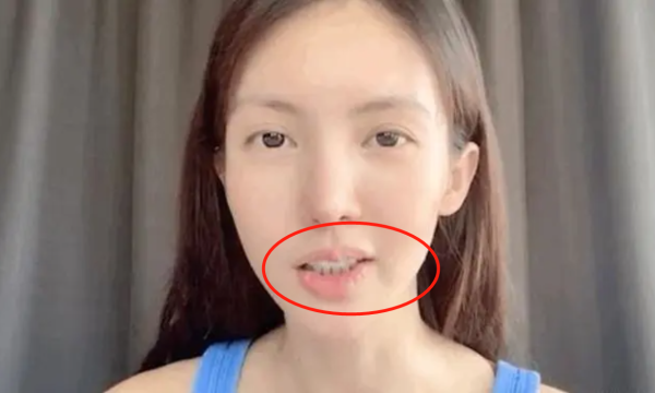 为什么有的女人嘴歪,美女怎么长的那么丑