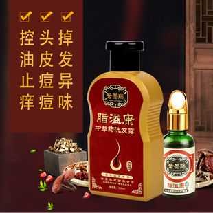 头皮痒用什么洗可以止痒（头皮痒用什么洗可以止痒效果好）