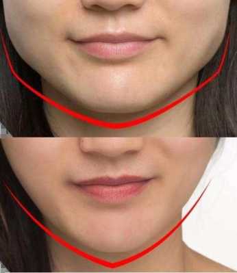 方形脸矫正方法,方型脸怎么变瓜子脸