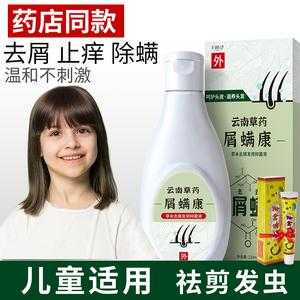 孩子头上有头屑用什么洗发水,儿童头皮屑多用什么洗发水效果好
