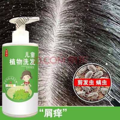 孩子头上有头屑用什么洗发水,儿童头皮屑多用什么洗发水效果好