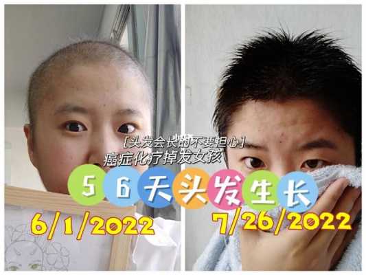 头发怎么长得快而浓密（化疗后头发怎么长得快而浓密）