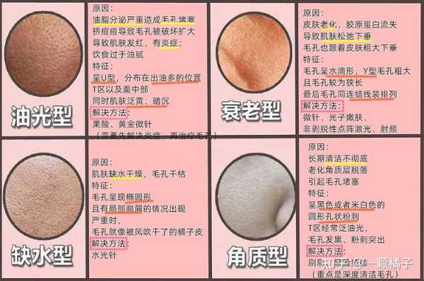 脸上的毛孔堵塞怎么办（毛孔堵塞可以挤出来吗）
