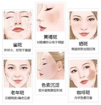 脸上长斑了该怎么办,面部长斑怎么办分析图