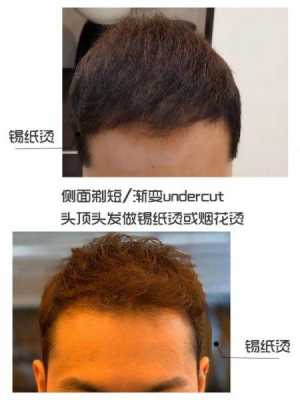 男生头发扁塌怎么办,头顶头发扁塌怎么办下面头发厚坠