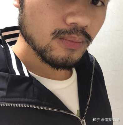 怎么长络腮胡,怎么长鬓毛