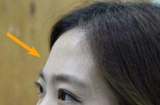 为什么人的额头大小差别很大？与智力有关吗,为什么额头大的人聪明