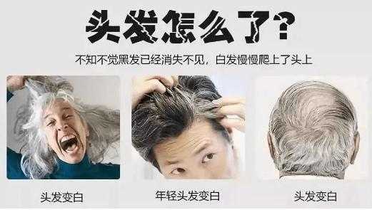 白发的原因是什么（白发的原因是什么）
