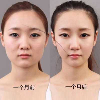 脸太大怎么办怎样变小（脸口大怎么变小）