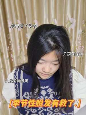 换季掉头发厉害怎么办（换季掉头发厉害怎么办女性）