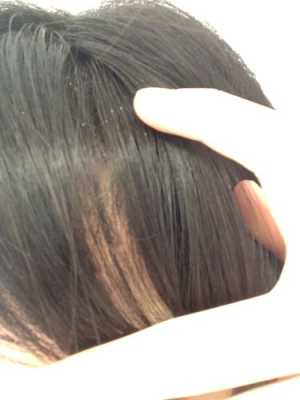 为什么自己头发有股香味,头发有腥味是什么原因引起的