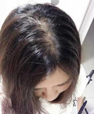 为什么自己头发有股香味,头发有腥味是什么原因引起的