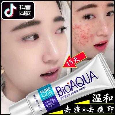 擦什么去痘印（脸上有痘印怎么消掉）