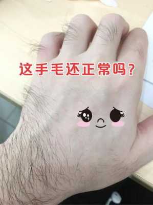 我的手背、脚上毛很长，请问体毛长有没有怎么方法治疗呢,毛发太多怎么办女生