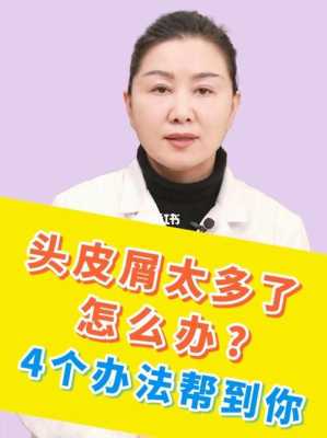头皮屑太多了怎么去除（头皮屑太多了怎么去除小妙招）