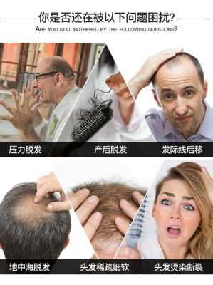 怎么才能密发（密发增发的小妙招）