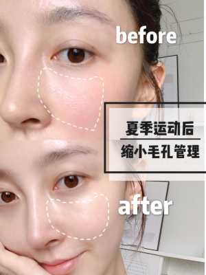 脸上毛孔怎么收缩（脸上毛孔怎么收缩最快）
