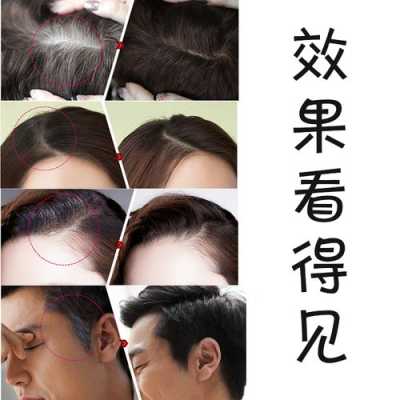 怎么补发根（怎么补发根染色才能一样）