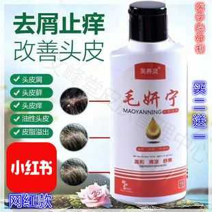 不洗头的情况下怎样快速清理头上的头皮屑,药店一种去头皮屑的药
