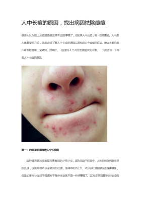为什么长闷痘（为什么长闷痘痘）