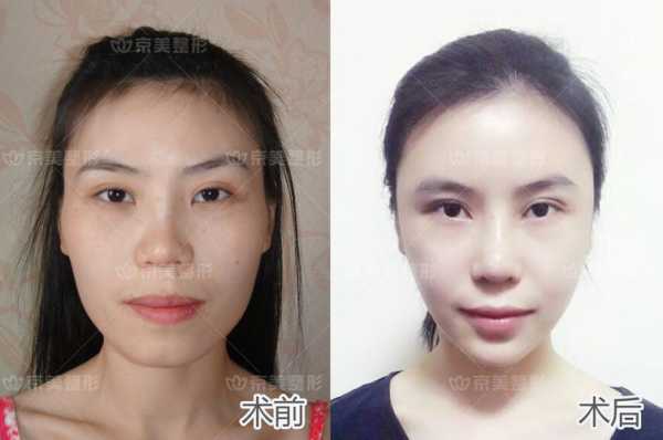 心形脸瘦下来是什么脸,心形脸是什么脸