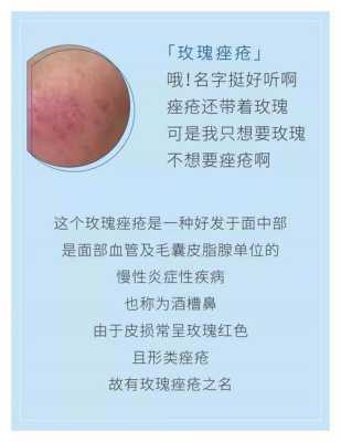 快速治疗痤疮最有效的方法有哪些,怎么消除脸上的痤疮杆菌