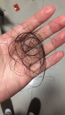 脱发严重是怎么回事,为什么掉头发很多但是头发还是很多