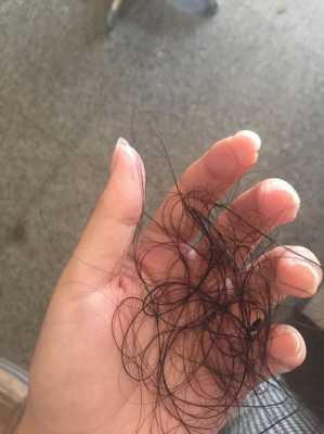 脱发严重是怎么回事,为什么掉头发很多但是头发还是很多