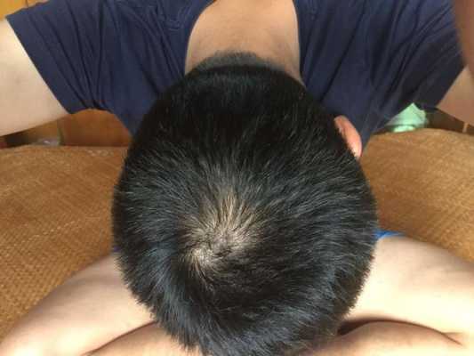 头发前面有个旋怎么办（头发前面有个旋，怎么办）
