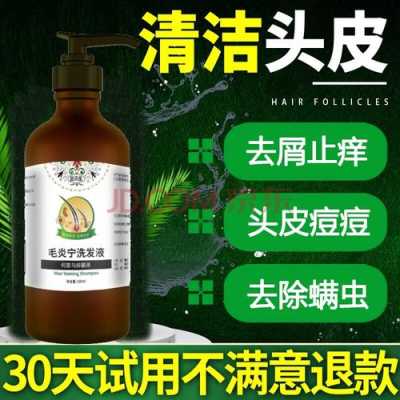 头皮痒头屑多怎么选择洗发水,头皮屑多什么洗发水好