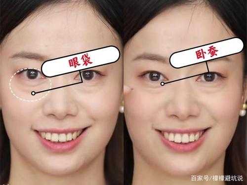 什么时候开始流行卧蚕,现在流行什么眼皮好看