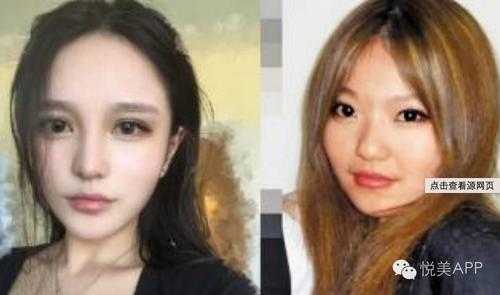 瓜子脸怎么整（天生瓜子脸的人多吗）