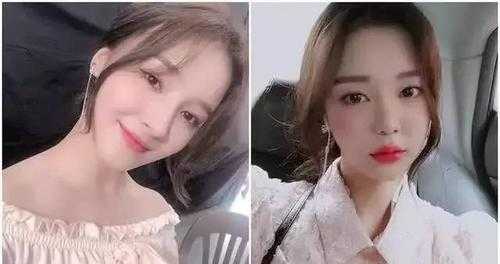 瓜子脸怎么整（天生瓜子脸的人多吗）