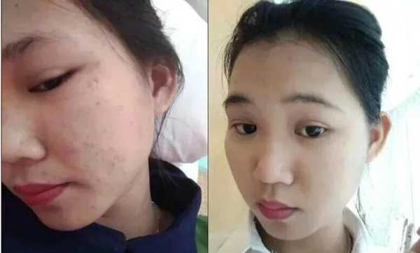 补水护肤品的使用方法是什么,补水精华液怎么用才正确方法使用
