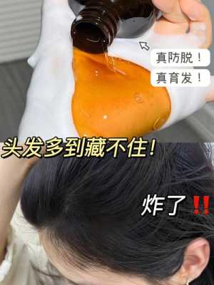 头发油怎么办掉头发（头发油怎么办掉头发多）