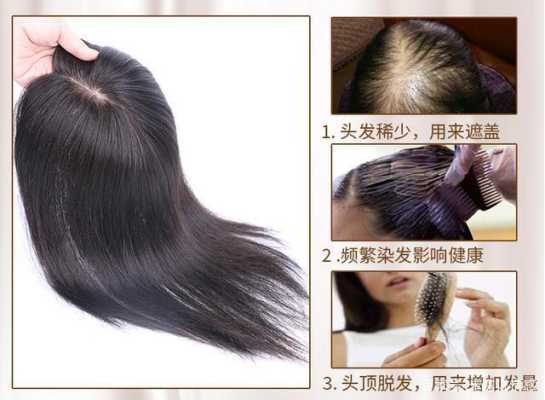假发怎么挑（买假发时要怎样挑选）