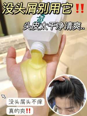 怎么去屑止痒（怎么去屑止痒最有效）