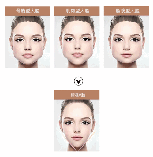 怎么让脸型变小（怎样将脸变小）