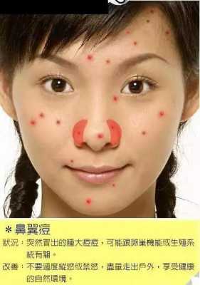 为什么鼻子上长痘痘怎么办（鼻子上面长痘痘原因）