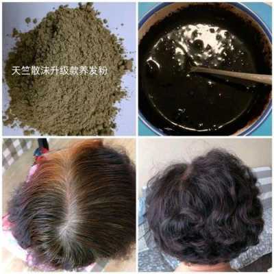 前额有很多白发这个症状该怎么调理呢,头顶白发吃什么药能变黑